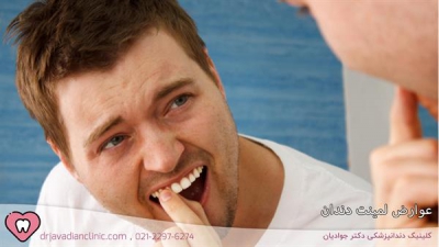 معایب و عوارض لمینت دندان | 7 راهکار پیشگیری + درمان