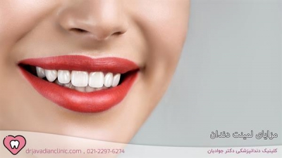 مزایای لمینت دندان | لمینت دندان برای چه کسانی مناسب است؟